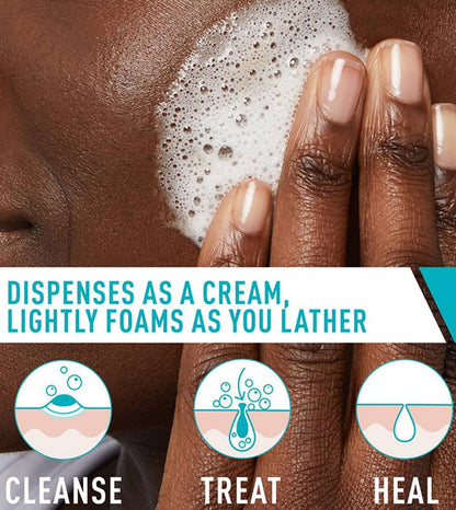 CeraVe Acne Foaming Cream Cleanser 150 ml