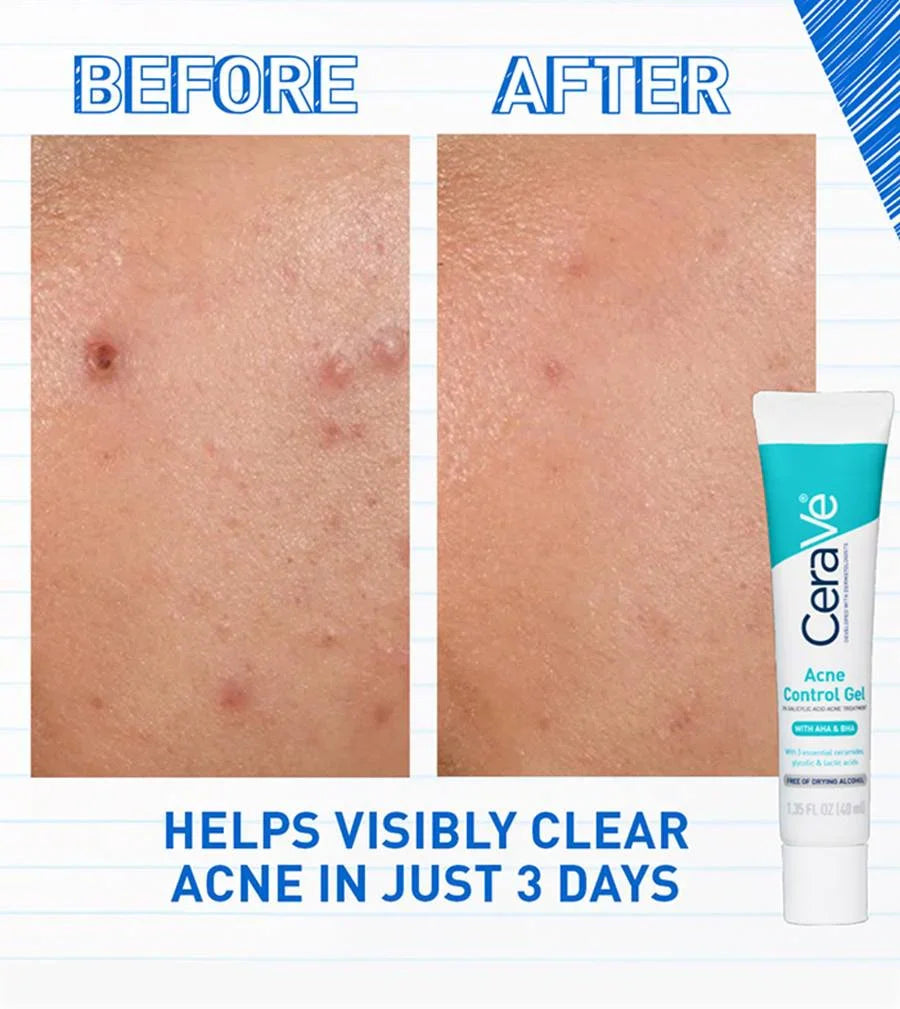 Cera ve Acne Control Gel 40 ml