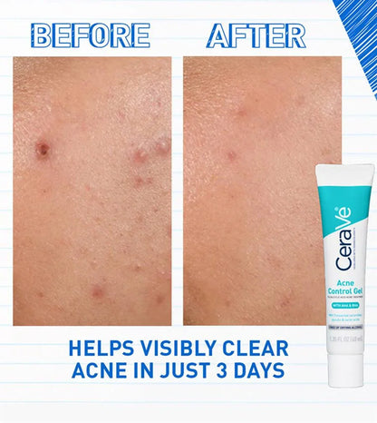Cera ve Acne Control Gel 40 ml